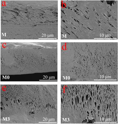 PVDF/MOFs mixed matrix ultrafiltration membrane for efficient water treatment